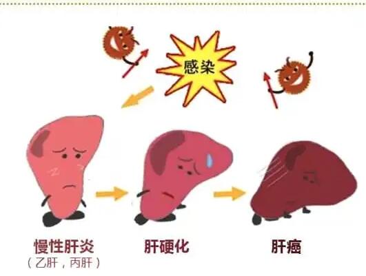 91免费看片网页版廠家提醒肝髒疾病治不好？要了解是否含鐵食物攝入多